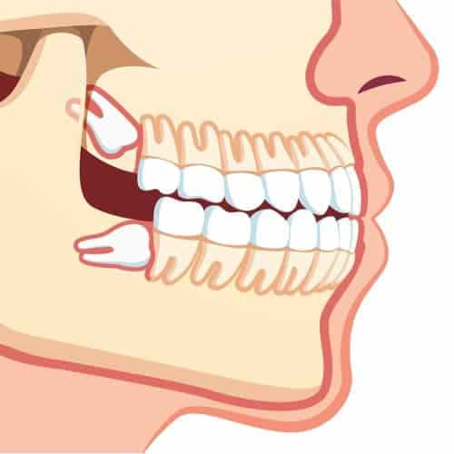Stomatologie et chirurgie orale à Rabat par le Professeur Benhalima
